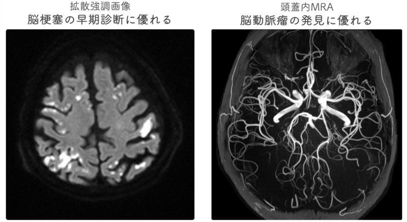 当院で導入しているMRI装置の画像 